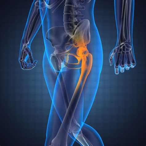 What Is The Best Anterior Hip Replacement Phoenix Spine And Joint
