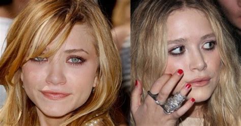 Elizabeth chase olsen is an american actress. Mary-Kate Olsen Plastic Surgery - Reconstruction of Her ...