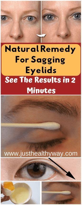 Here Are 4 Steps For Tighten The Loose Skin On Eyelids Natural