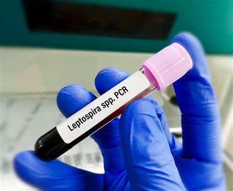 Premium Photo Blood Sample For Leptospira Spp Pcr Test