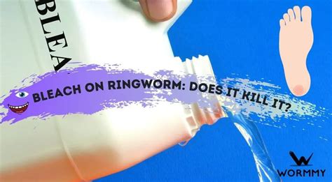 Bleach On Ringworm Does It Kill It On Skin And Surfaces