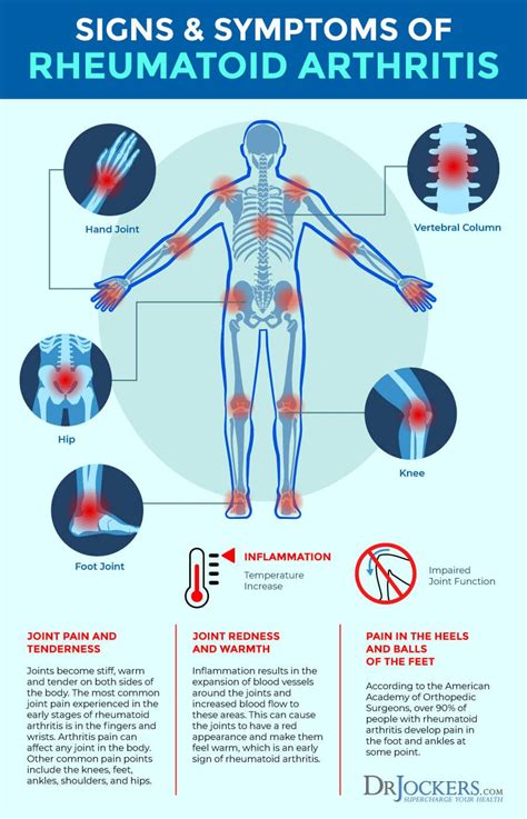 Rheumatoid Arthritis Symptoms Causes And Natural Support Strategies