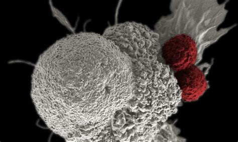 How Immunotherapy Is Transforming Cancer Treatment And Patient Care