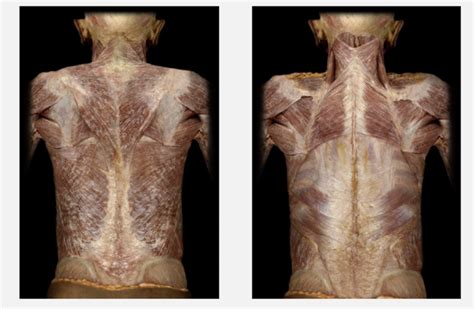 Cadaver Back Muscles Diagram Quizlet