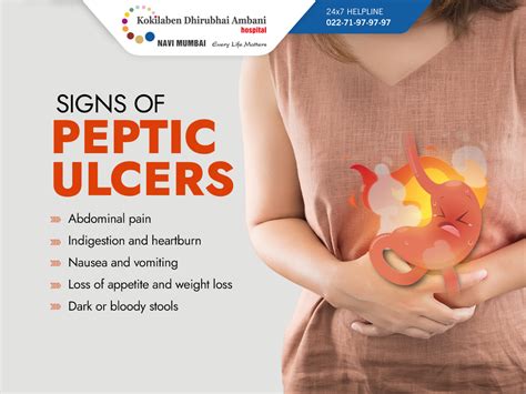 Signs Of Stomach Ulcer Hot Sex Picture