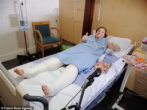 Mother Has Three Litres Of Fat Sucked Out Of Her Legs In Liposuction