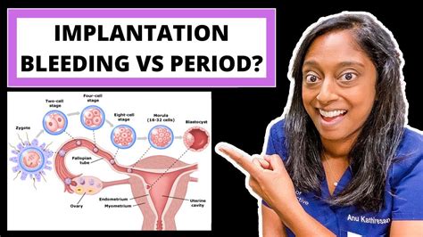 Implantation Bleeding Vs Period How To Tell The Difference Youtube