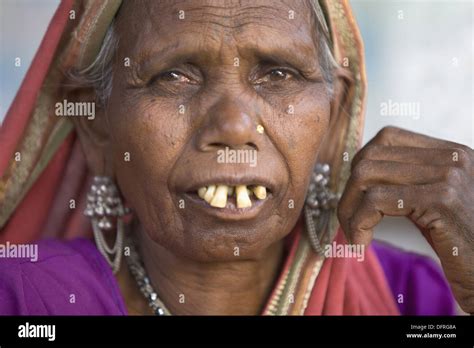 Close Up Of A Korku Tribal Women With Bucked Teeth Khalwa Jharikheda