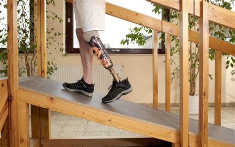 Life With A New Limb Prosthetic Tips The Surgical Clinic