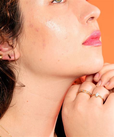 What Is Orange Peel Skin—and How Can You Get Rid Of It Orange Peel