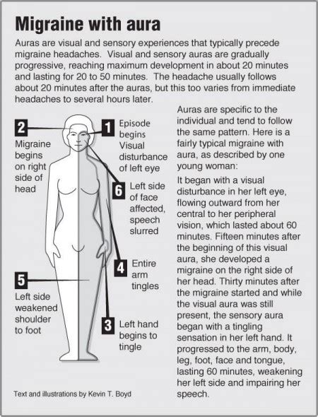 Migraine With Aura Pointfinder Health Infographics