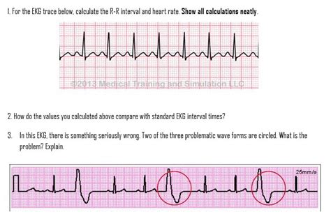 How To Calculate Heart Rate Ekg