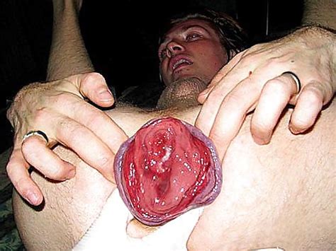 Mancunt From Bi Men Nudist Asshole Extrem Porn Pictures Xxx Photos Sex Images Pictoa