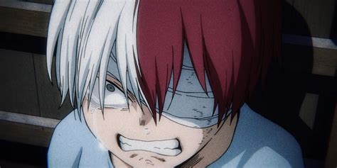 How Did Todoroki Get His Scar And More Questions About Him Answered
