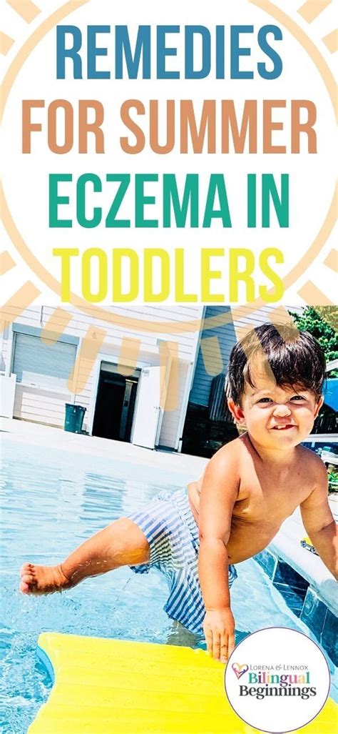 11 Tips And Remedies For Treating Toddler Eczema — Lorena And Lennox