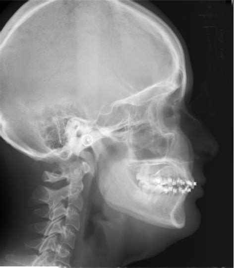 Radiografía Cefálica Lateral Grupo Odontológico Malavé