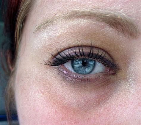 Under Eye Bags Puffiness Under The Eyes Causes Dr U