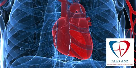 Cals Anz Cardiac Surgery Advanced Life Support 29 Oct 2021