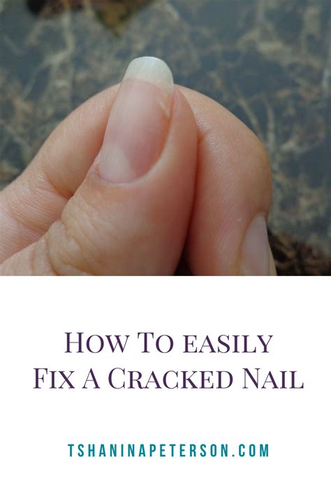 7 Easy Steps To Fix A Cracked Nail At Home Tshanina Peterson Nails