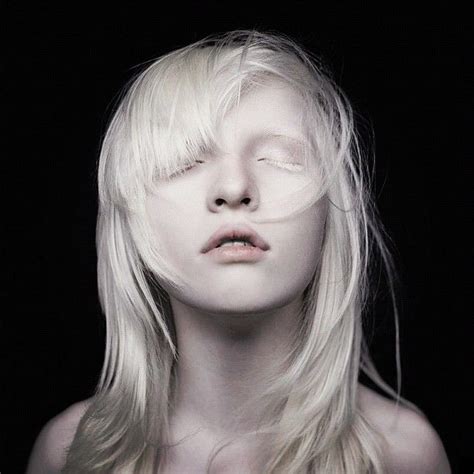 Nastya Kumarova Russian Albino Model Albino Girl Albino Model Albinism