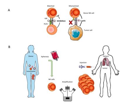 Adoptive Nk Cell Therapy Cimaas