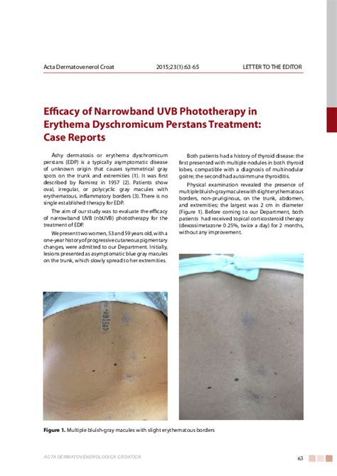 Pdf Efficacy Of Narrowband Uvb Phototherapy In Erythema Dyschromicum