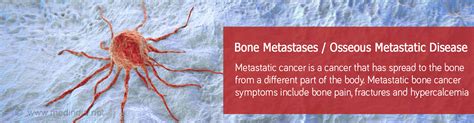 Bone Metastases Osseous Metastatic Disease Causes Symptoms