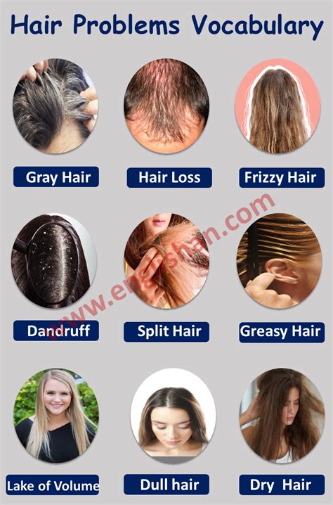 Details More Than 78 Common Hair Problems Latest Vn
