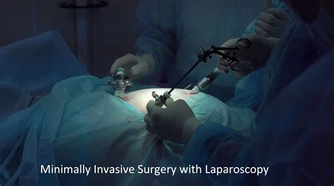 Minimally Invasive Liver Surgery In Singapore Ls Lee Surgery Clinic