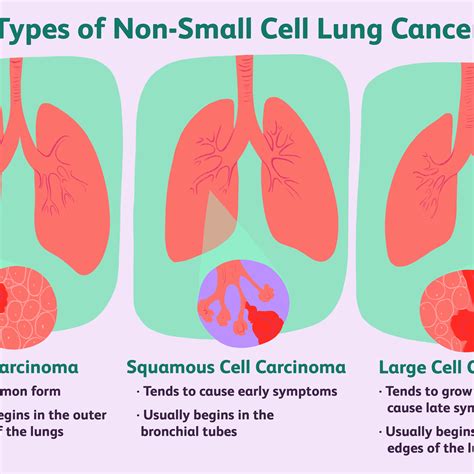 What Are The First Signs Of Small Cell Lung Cancer Study Flow Diagram