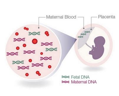 We did not find results for: NIPT test Perth | Non-Invasive Prenatal Tests | Blood Test ...