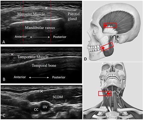 Frontiers Ultrasound Imaging Of Headneck Muscles And Their Fasciae