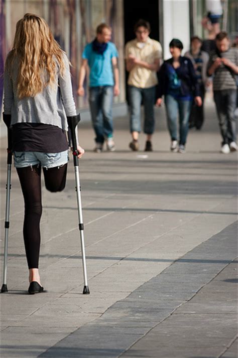 Rak Amputee With Crutches By Sophiecalls On Deviantart