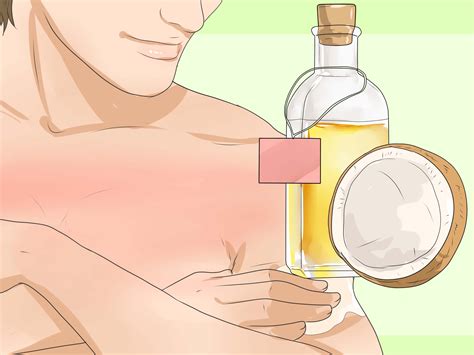 how to turn sunburn into a tan 12 steps with pictures wikihow