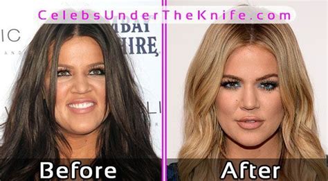 The luxury of standing (or squatting down) next to this queen!!! Kourtney Kardashian Plastic Surgery Before After Photos ...