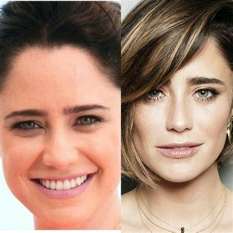 13 best MD Codes images on Pinterest | Dermal fillers, Medicine and Facials