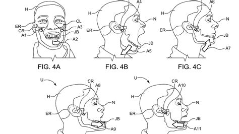 アップルによる顔の表情で操作するスマートグラスの特許が登録に（栗原潔） エキスパート Yahooニュース
