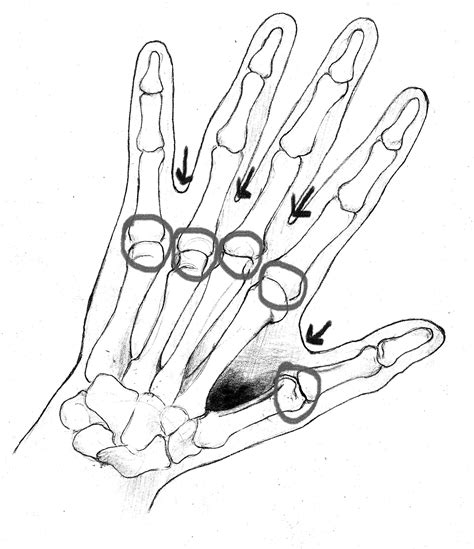 How to draw a skeleton hand really easy drawing tutorial. 5 Mistakes Artists Make Painting & Drawing Hands ...
