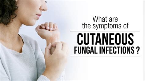 Symptoms Of Cutaneous Fungal Infection Skin Infection Skin Care