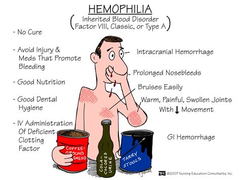 Nursing School Medical Surgical Nursing Mnemonics