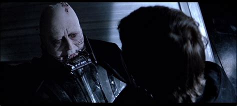 Star Wars Injuries Of Darth Vader Anakin Skywalker Star Wars Luke