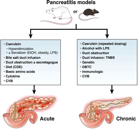 Models Of Acute And Chronic Pancreatitis Gastroenterology