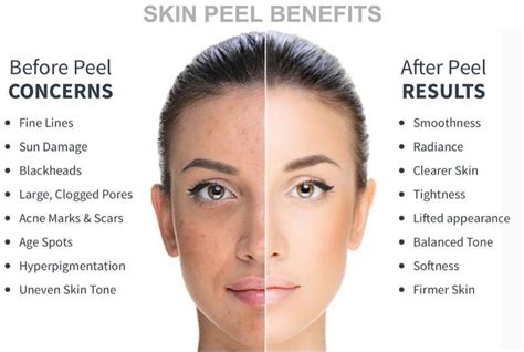 Types Of Chemical Peels Mayha Patel Do Faad Dermatologist