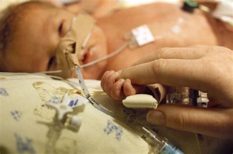 What Is The Premature Baby Survival Rate