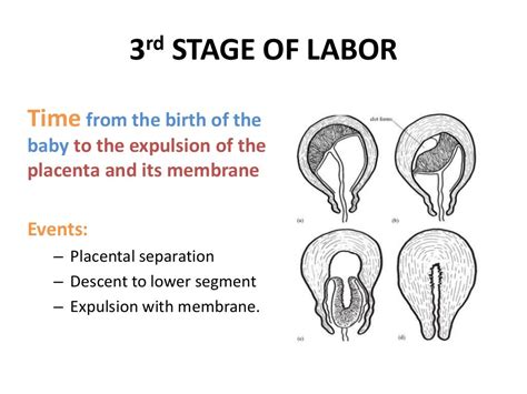 Complications Of 3rd Stage Of Labor