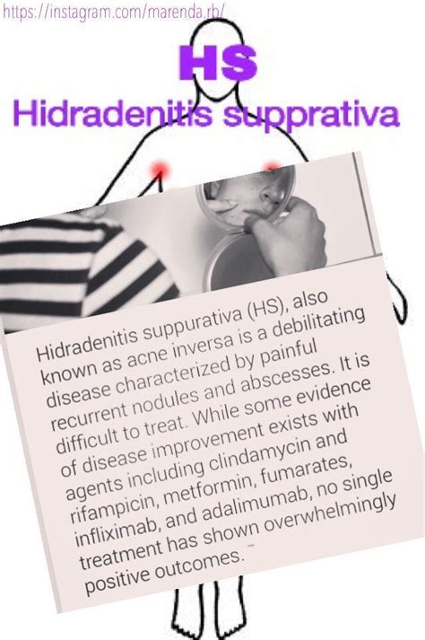 What Is Hidradenitis Suppurativa In 2020 Acne Inversa Metformin