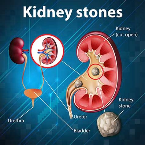 Top 8 Kidney Pain Symptoms And Causes You Should Never Ignore