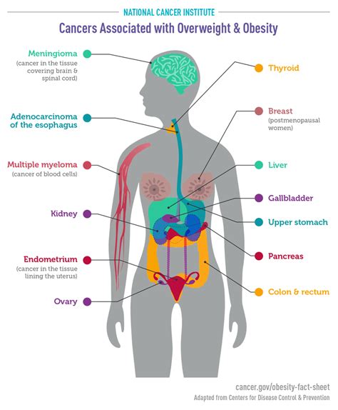 Obesity And Cancer Fact Sheet National Cancer Institute