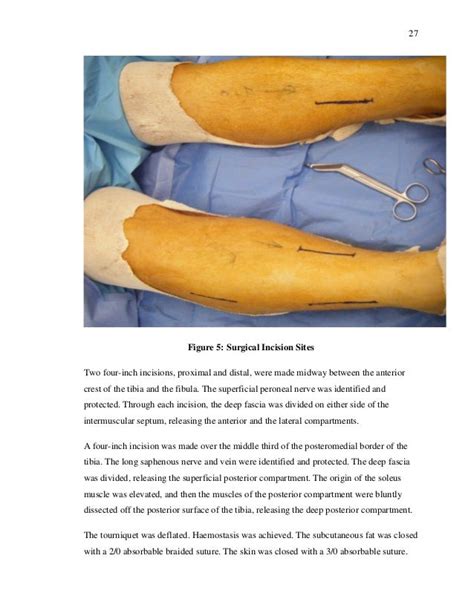 Assessing Long Term Outcomes In Individuals Undergoing Fasciotomy
