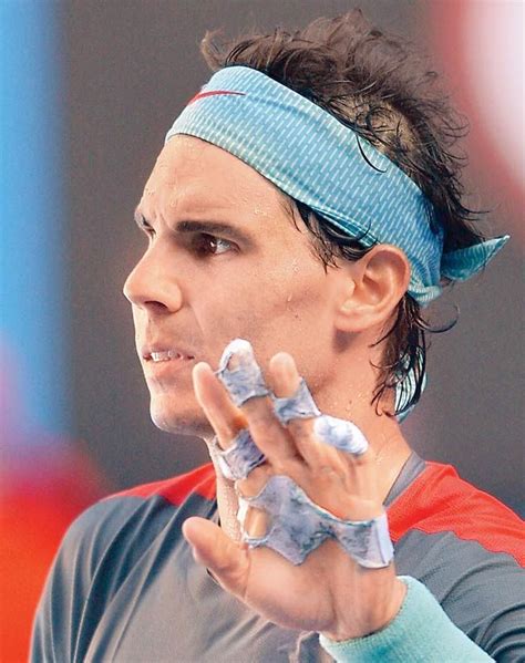 Rafael Nadal Blister Hand Tennis Tennis Court Tennis